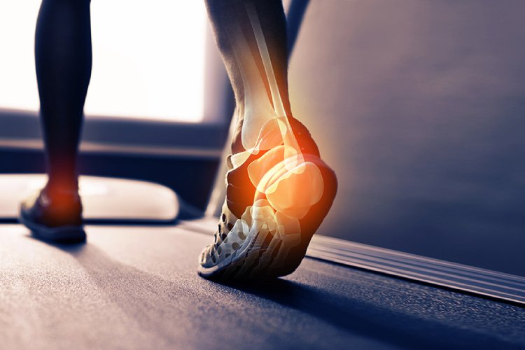 Ankle Replacement Surgery