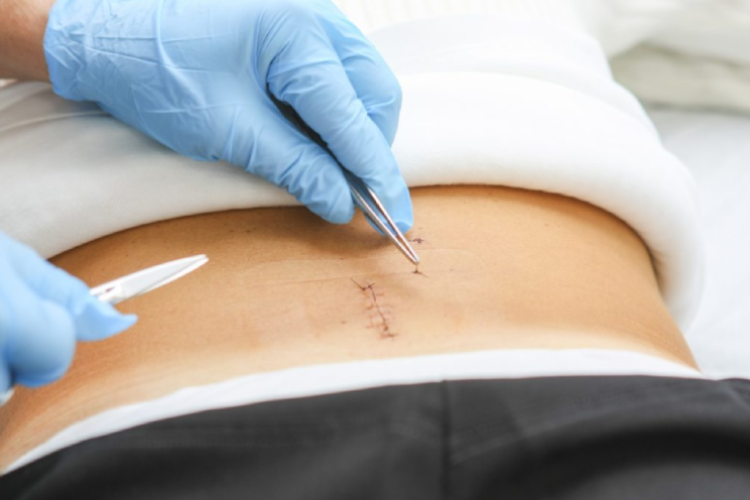 Minimally Invasive Spine Surgery