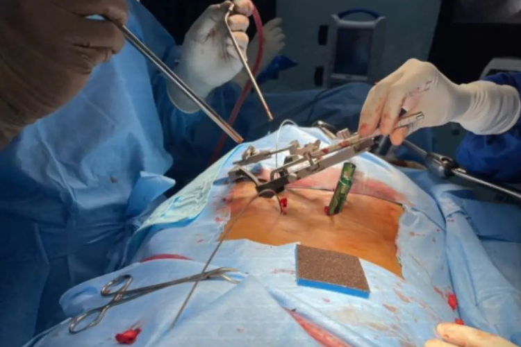 Spinal Stabilization and Fusion Surgery