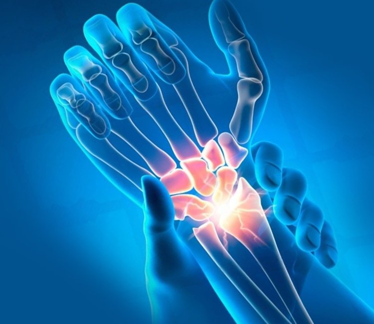 Trauma and Fracture Care Treatment 650