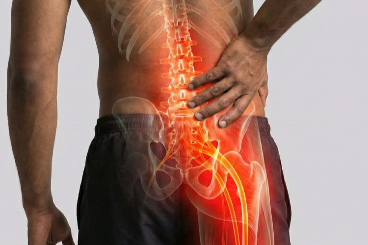 Treatment for Slip Disc and Sciatica