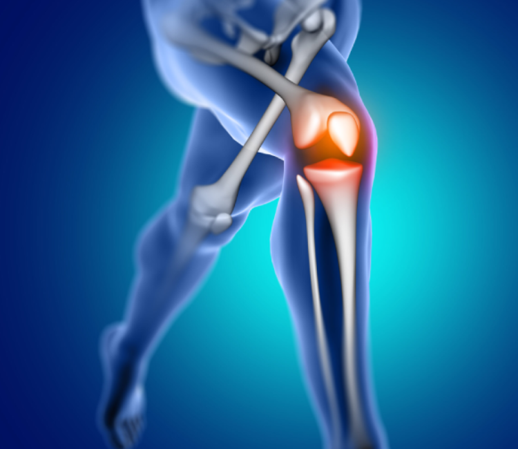joint replacement